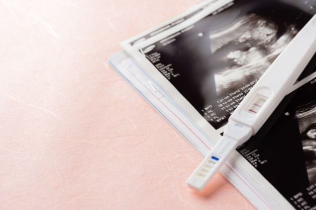 Imagem de um teste de gravidez e um exame de ultrassom
